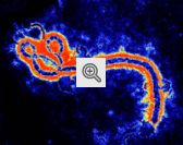 Ebola Ampliado em Microscópio 260.000 Vezes